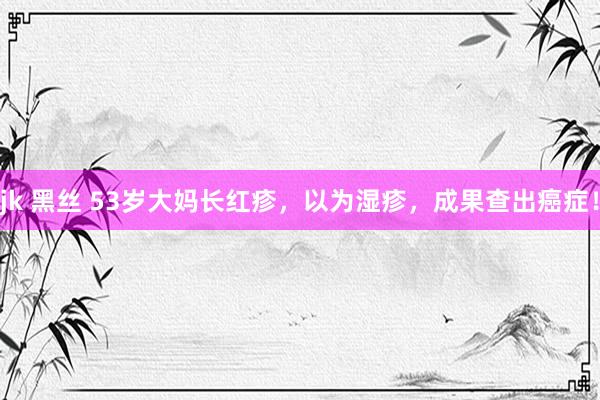 jk 黑丝 53岁大妈长红疹，以为湿疹，成果查出癌症！